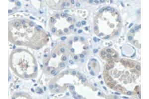 Immunohistochemistry (IHC) image for anti-Signal Transducing Adaptor Molecule (SH3 Domain and ITAM Motif) 2 (STAM2) (AA 1-377) antibody (ABIN7444217)