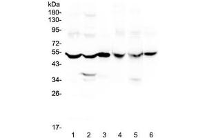 Western blot testing of rat 1) brain, 2) liver, 3) small intestine and mouse 4) brain, 5) liver and 6) small intestine lysate with GDA antibody at 0. (GDA 抗体)