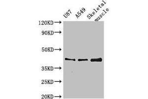 Western Blot Positive WB detected in: U87 whole cell lysate, A549 whole cell lysate, Mouse skeletal muscle tissue All lanes: B3GALT4 antibody at 3 μg/mL Secondary Goat polyclonal to rabbit IgG at 1/50000 dilution Predicted band size: 42 kDa Observed band size: 42 kDa