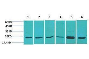 Western Blotting (WB) image for anti-Superoxide Dismutase 2, Mitochondrial (SOD2) antibody (ABIN3181553) (SOD2 抗体)