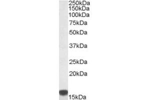 Image no. 1 for anti-S100 Calcium Binding Protein A9 (S100A9) (Internal Region) antibody (ABIN375088) (S100A9 抗体  (Internal Region))