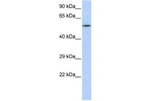 CACNB1 antibody used at 1 ug/ml to detect target protein.