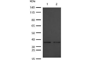 All lanes : OXGR1 Rabbit mAb at 1/1k dilution Lane 1 : Mouse Kidney lysates Lane 2 : Rat Spleen lysates Lysates/proteins at 20 μg per lane. (Recombinant OXGR1 抗体)