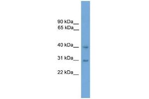WB Suggested Anti-MAPK13 Antibody Titration: 0. (MAPK13 抗体  (Middle Region))