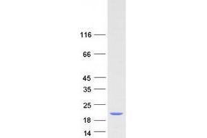 Validation with Western Blot