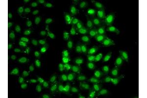 Immunofluorescence analysis of U20S cell using PSMD8 antibody. (PSMD8 抗体)