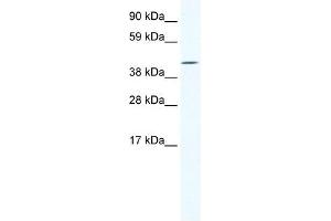Western Blot showing IRX6 antibody used at a concentration of 1-2 ug/ml to detect its target protein. (IRX6 抗体  (C-Term))