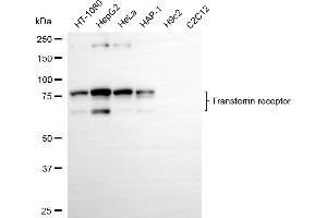 Western blotting analysis using transferrin receptor antibody (ABIN7800603). (Recombinant Transferrin Receptor 抗体)