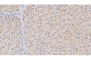 Immunohistochemistry (IHC) image for anti-Superoxide Dismutase 1, Soluble (SOD1) (AA 2-154) antibody (ABIN7429208)