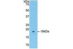 Detection of Recombinant BCL2L11, Human using Polyclonal Antibody to Bcl2 Like Protein 11 (BCL2L11) (BIM 抗体  (AA 2-120))