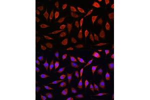Immunofluorescence (IF) image for anti-Solute Carrier Family 39 (Zinc Transporter), Member 8 (SLC39A8) (AA 180-300) antibody (ABIN6147995)