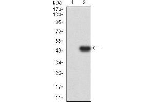 Western blot analysis using C3C mAb against HEK293 (1) and C3C (AA: 1521-1649)-hIgGFc transfected HEK293 (2) cell lysate. (Complement C3c 抗体  (AA 1521-1649))