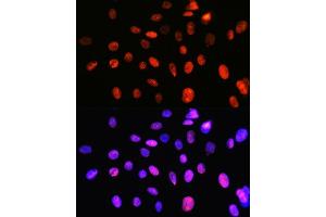 Immunofluorescence (IF) image for anti-Topoisomerase (DNA) I (TOP1) antibody (ABIN7270850)