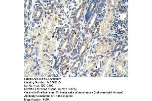 Rabbit Anti-EIF4E2 Antibody  Paraffin Embedded Tissue: Human Kidney Cellular Data: Epithelial cells of renal tubule Antibody Concentration: 4.