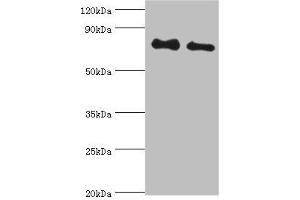 Western blot All lanes: Cytoplasmic tyrosine-protein kinase BMX antibody at 4 μg/mL Lane 1: A549 whole cell lysate Lane 2: Mouse heart tissue Secondary Goat polyclonal to rabbit IgG at 1/10000 dilution Predicted band size: 78 kDa Observed band size: 78 kDa (BMX 抗体  (AA 65-280))