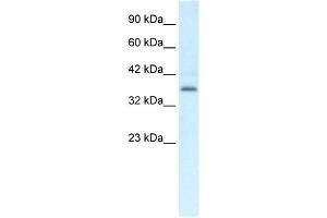 CMKLR1 antibody (70R-10508) used at 0. (CMKLR1 抗体  (C-Term))