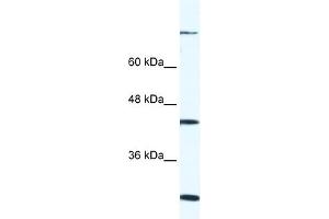 WB Suggested Anti-FGD1 Antibody Titration: 0. (FGD1 抗体  (C-Term))