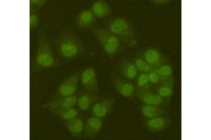 Immunofluorescent analysis of Hela cells fixed fixed by 4 % paraformaldehyde and using SIRT6 mouse mAb (dilution 1:100). (SIRT6 抗体)