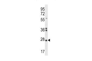 NKAIN1 Antibody (C-term) (ABIN656410 and ABIN2845704) western blot analysis in K562 cell line lysates (35 μg/lane). (NKAIN1 抗体  (C-Term))