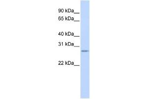 Vasohibin 1 antibody used at 1 ug/ml to detect target protein. (VASH1 抗体  (N-Term))