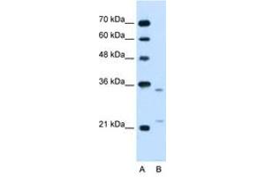 Image no. 1 for anti-Low Density Lipoprotein Receptor-Related Protein Associated Protein 1 (LRPAP1) (AA 258-307) antibody (ABIN205076) (LRPAP1 抗体  (AA 258-307))