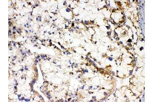 IHC analysis of APOL1 using anti-APOL1 antibody (ABIN7600725). (APOL1 抗体  (AA 228-398))