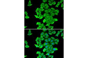 Immunofluorescence analysis of HeLa cell using SMYD2 antibody. (SMYD2A 抗体)