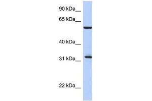 Western Blot showing CDC34 antibody used at a concentration of 1-2 ug/ml to detect its target protein. (CDC34 抗体  (Middle Region))