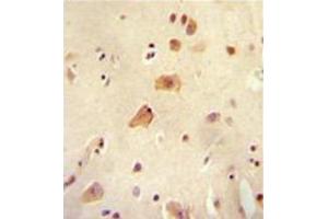 Formalin fixed, paraffin embedded human brain tissue stained with RICH2 Antibody (C-term) followed by peroxidase conjugation of the secondary antibody and DAB staining. (ARHGAP44 抗体  (C-Term))