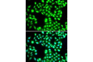 Immunofluorescence analysis of MCF-7 cells using YTHDC1 antibody (ABIN5974420). (YTHDC1 抗体)