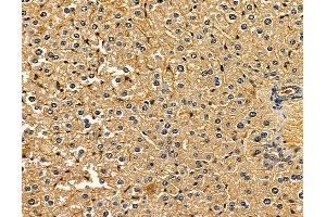 ABIN6265009 and ABIN6279806 at 1/100 staining mouse liver tissue by IHC-P.