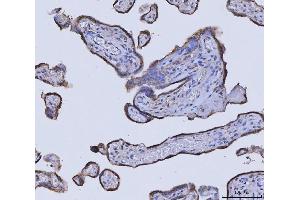 IHC analysis of GLDC using anti-GLDC antibody (ABIN7602072).