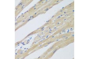 Immunohistochemistry of paraffin-embedded mouse heart using WDR77 antibody at dilution of 1:200 (40x lens). (WDR77 抗体)