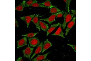 Immunofluorescence (IF) image for anti-Glutathione S-Transferase mu 4 (GSTM4) antibody (ABIN6939574)