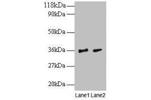 Western blot All lanes: SNRPG antibody at 2 μg/mL Lane 1: EC109 whole cell lysate Lane 2: 293T whole cell lysate Secondary Goat polyclonal to rabbit IgG at 1/15000 dilution Predicted band size: 9 kDa Observed band size: 36 kDa (SNRPG 抗体  (AA 1-76))
