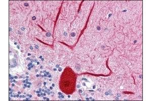 Human Brain, cerebellum: Formalin-Fixed, Paraffin-Embedded (FFPE) (ENPEP 抗体  (Tyr182))