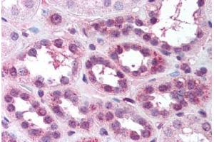 Human Kidney (formalin-fixed, paraffin-embedded) stained with RELA antibody ABIN218582 at 1:500 followed by biotinylated goat anti-rabbit IgG secondary antibody ABIN481713, alkaline phosphatase-streptavidin and chromogen. (NF-kB p65 抗体  (pSer529))
