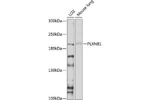 Western blot analysis of extracts of various cell lines, using PLXNB1 antibody (ABIN6129763, ABIN6145806, ABIN6145807 and ABIN6214109) at 1:1000 dilution. (PLXNB1 抗体  (AA 250-470))