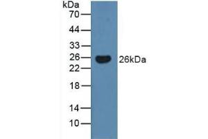 Detection of BMF in Human Serum using Polyclonal Antibody to Bcl2 Modifying Factor (BMF) (BMF 抗体  (AA 1-181))