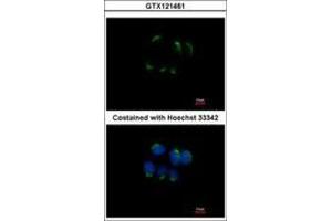 Image no. 3 for anti-Trefoil Factor 1 (TFF1) (AA 1-84) antibody (ABIN1501358) (TFF1 抗体  (AA 1-84))