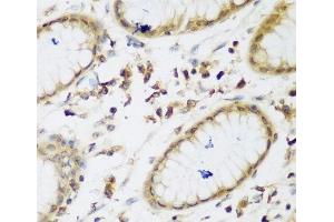 Immunohistochemistry of paraffin-embedded Human gastric using UBE3A Polyclonal Antibody at dilution of 1:200 (40x lens). (ube3a 抗体)