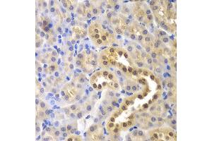 Immunohistochemistry of paraffin-embedded mouse kidney using GLO1 antibody at dilution of 1:200 (400x lens). (GLO1 抗体)