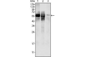 Western blot analysis using GPI mouse mAb against HepG2 (1) , SMMC-7721 (2) cell lysate and rat liver tissues lysate (3). (GPI 抗体)