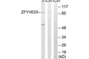 Western blot analysis of extracts from HuvEc/Jurkat cells, using ZFYVE20 Antibody. (Rabenosyn 5 抗体  (AA 145-194))