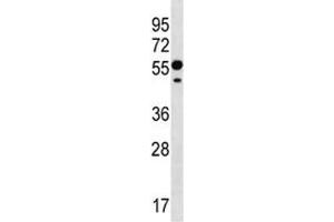 RNF8 antibody western blot analysis in CEM lysate. (RNF8 抗体  (AA 335-364))