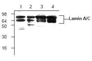 Image no. 1 for anti-Lamin A/C (LMNA) antibody (ABIN127068) (Lamin A/C 抗体)