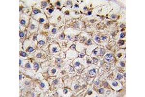 IHC analysis of FFPE human testis tissue stained with LC3 II antibody (LC3B 抗体  (AA 77-106))