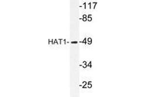 Western blot analysis of HAT1 antibody in extracts from LOVO cells. (HAT1 抗体)