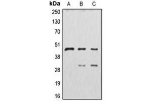 Western blot analysis of Cathepsin D expression in HepG2 (A), MDAMB231 (B), MCF7 (C) whole cell lysates. (Cathepsin D 抗体  (Center))