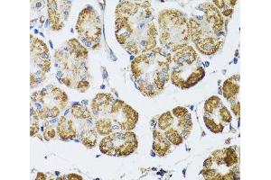 Immunohistochemistry of paraffin-embedded Human stomach using HDAC6 Polyclonal Antibody at dilution of 1:100 (40x lens). (HDAC6 抗体)